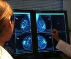the importance of breast health