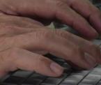 carpal tunnel syndrome treatment