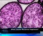 the causes of bacterial vaginosis