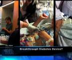 bionic pancreas trial technology