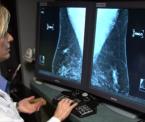 the importance of breast cancer screening