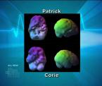 3d brain scan technology explained
