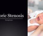 symptoms of pyloric stenosis