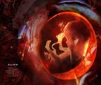 can a fetus pass gas