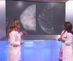 contrast enhanced spectral mammography procedure explained