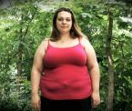 danielles robotic gastric bypass surgery