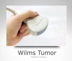 wilms tumor in children