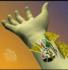 hand transplant animation