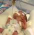 the dangers of respiratory distress syndrome in newborns