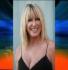 suzanne somers cosmetic procedures