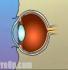 alternatives for lasik laser eye surgery