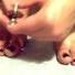 how to prevent and treat ingrown toenails