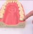 how gerd causes tooth sensitivity