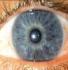 surgical procedure for chronic bloodshot eyes
