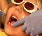 kids and cavities a rising trend